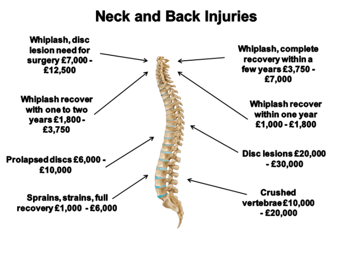whiplash injury neck symptoms accident claims
